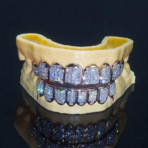 Ultimate Iced-Out Lab Diamond Grillz
