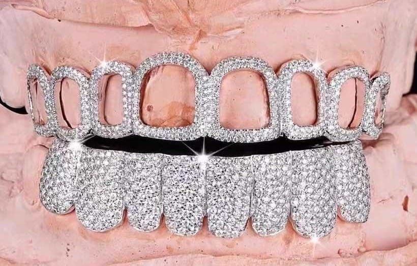 open-face-moissanite-grillz