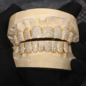 Royal Gold Diamond Ice Grillz